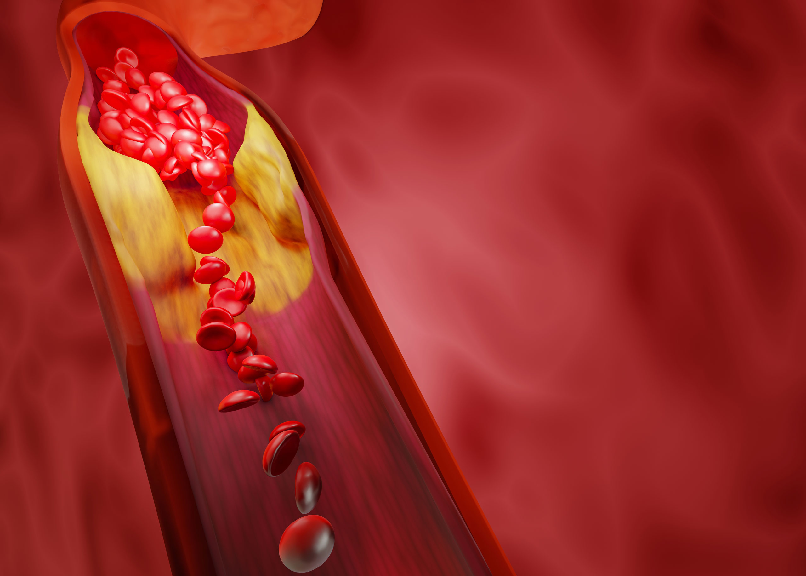 25 Fatti Su Iperlipidemia