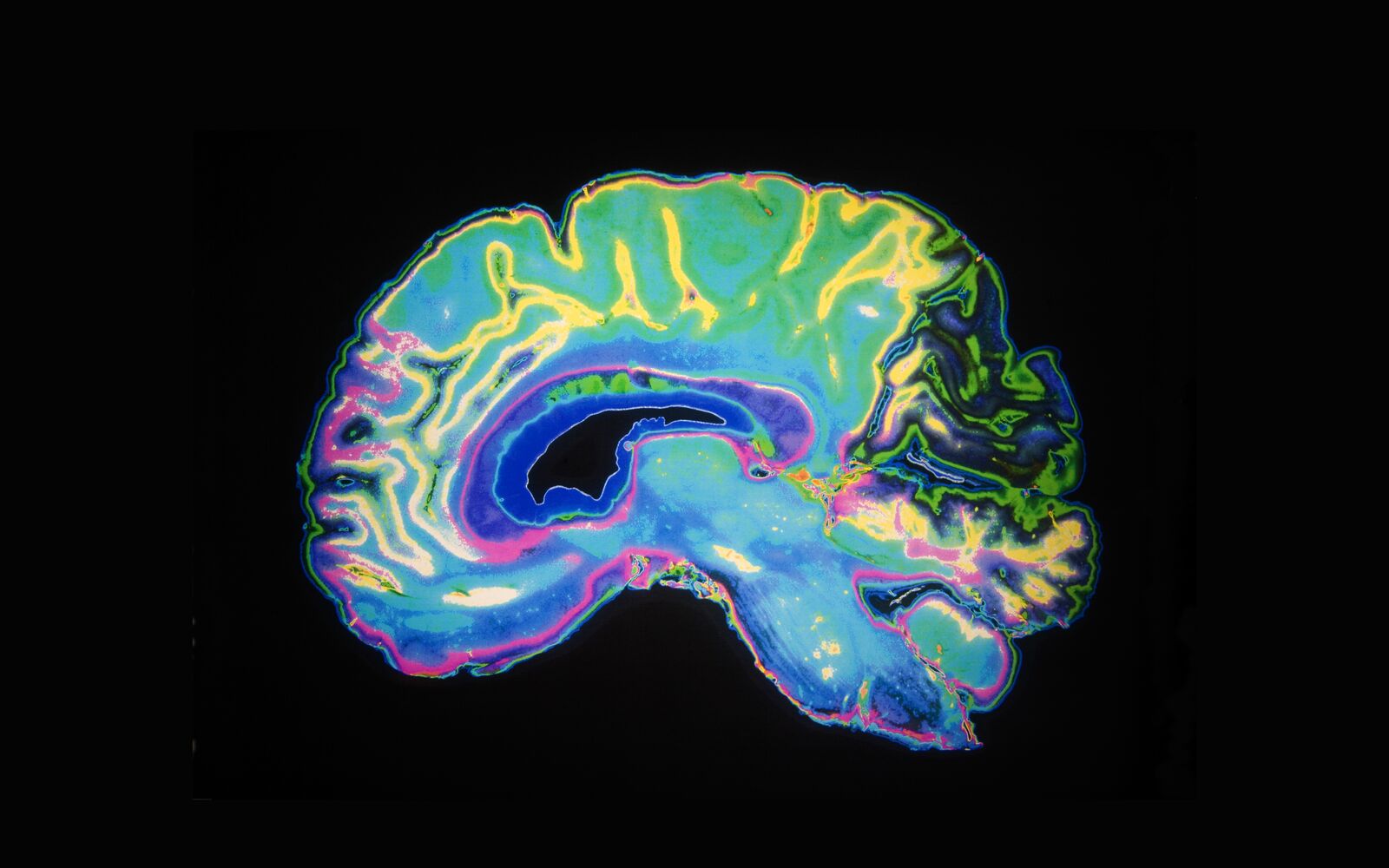 29 Fatti Su Neuroscienza