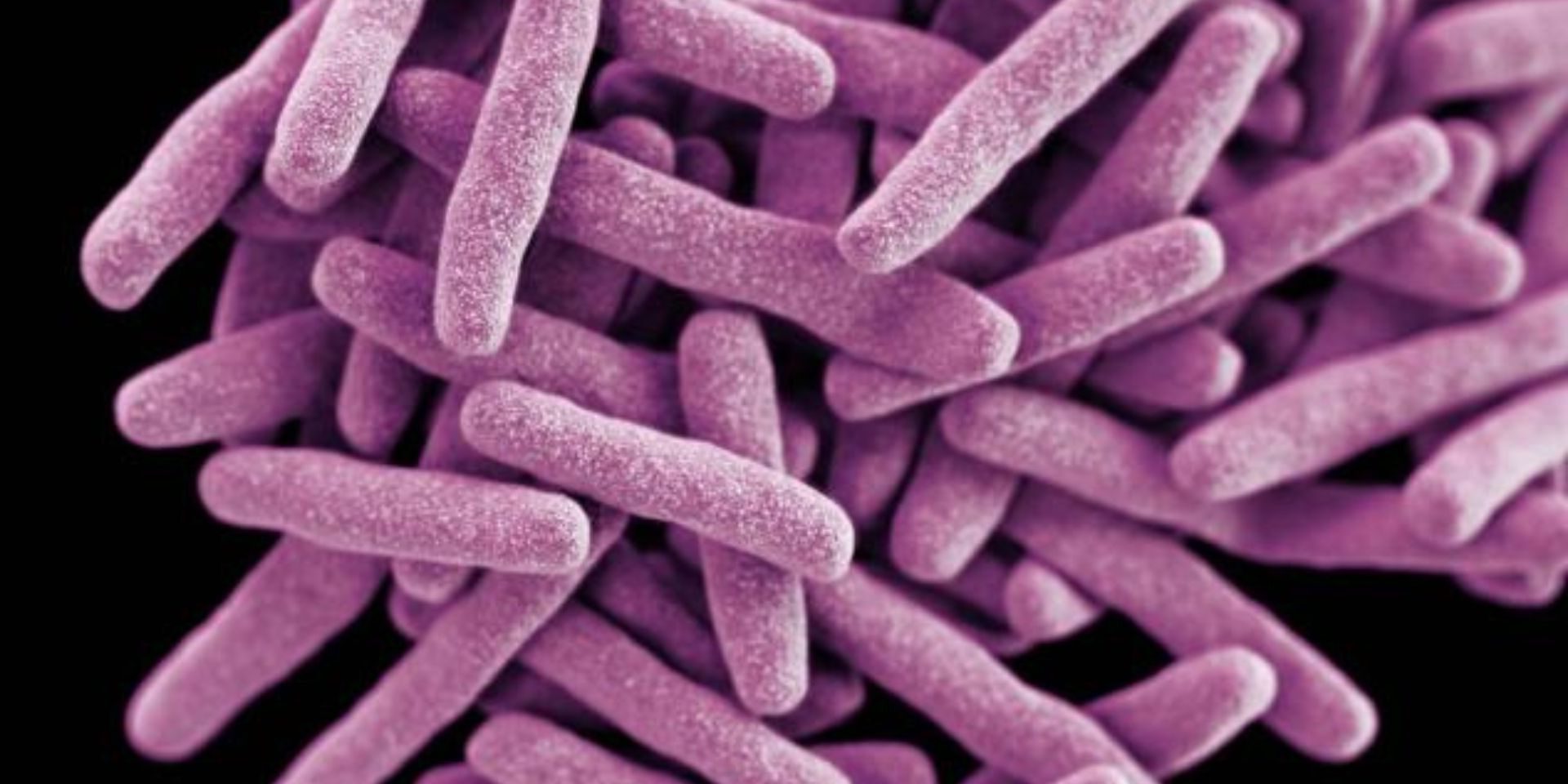 29 Fatti Su Tubercolosi