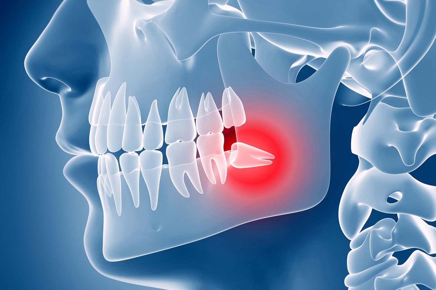 30 Fatti Su Dente Del Giudizio